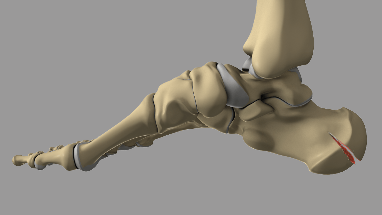 Stress Fracture of the Calcaneus - Everything You Need To Know - Dr. Nabil  Ebraheim - YouTube